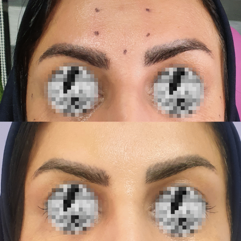 ترمیم پوست صورت